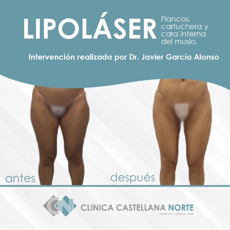 clinicacastellananorte-dr-javiergarciaalonso-dra-griselcastro (10)