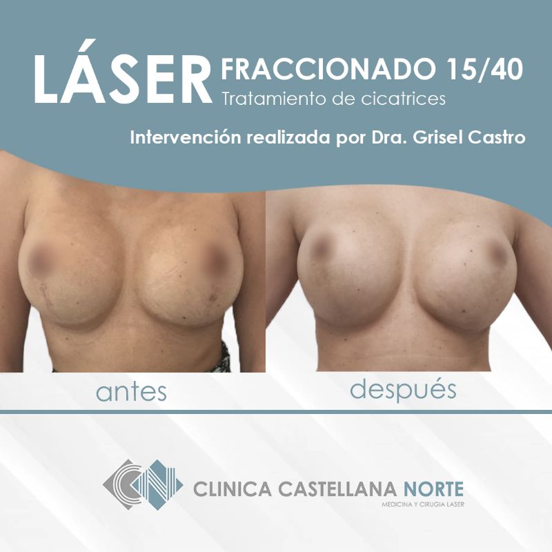 clinicacastellananorte-dr-javiergarciaalonso-dra-griselcastro (8)